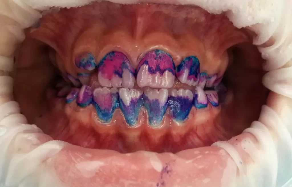 індикатор нальоту