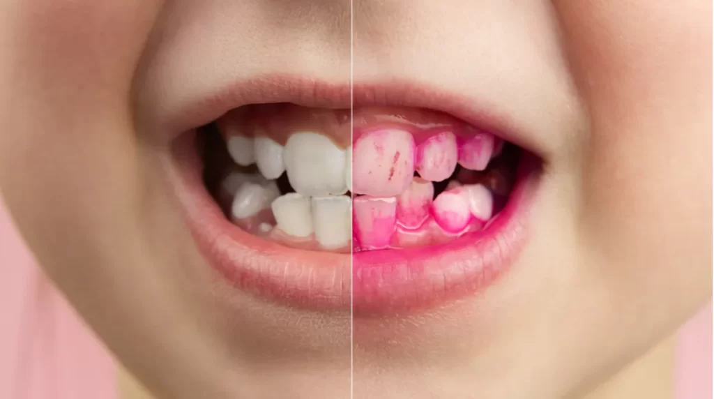 приклад - шкала індикатора